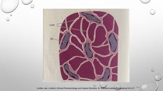 Lindhe, Jan. Lindhe’s Clinical Periodontology and Implant Dentistry 7e. Editorial médica Panamerica S.A.C.F,
 