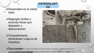OSTEOCLAST
OS
✔Desarrollan en la matriz
ósea
✔Segregan ácidos y
enzimas líticas que
degradan y
descomponen
✔Compartimiento
extracelular (Laguna de
Howship)
✔Descienden
monocito/macrófago
Nanci, Antonio. Ten Cate’s Oral Histology : Development, Structure, and Function. Philadelphia, Elsevier, 2017.
Lindhe, Jan. Lindhe’s Clinical Periodontology and Implant Dentistry 7e. Editorial médica Panamerica S.A.C.F, 2017.
 