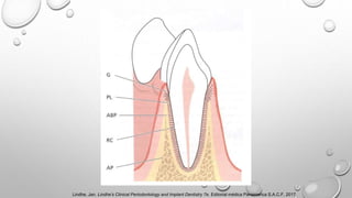 Lindhe, Jan. Lindhe’s Clinical Periodontology and Implant Dentistry 7e. Editorial médica Panamerica S.A.C.F, 2017.
 