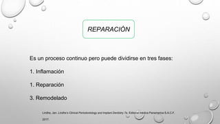 REPARACIÓN
Es un proceso continuo pero puede dividirse en tres fases:
1. Inflamación
1. Reparación
3. Remodelado
Lindhe, Jan. Lindhe’s Clinical Periodontology and Implant Dentistry 7e. Editorial médica Panamerica S.A.C.F,
2017.
 