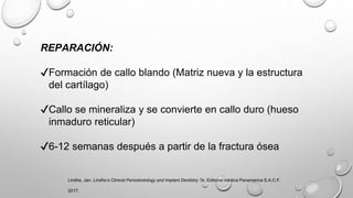 REPARACIÓN:
✔Formación de callo blando (Matriz nueva y la estructura
del cartílago)
✔Callo se mineraliza y se convierte en callo duro (hueso
inmaduro reticular)
✔6-12 semanas después a partir de la fractura ósea
Lindhe, Jan. Lindhe’s Clinical Periodontology and Implant Dentistry 7e. Editorial médica Panamerica S.A.C.F,
2017.
 