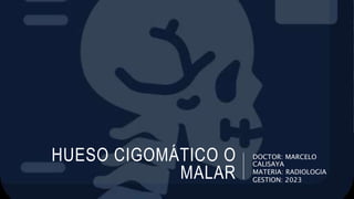 HUESO CIGOMÁTICO O
MALAR
DOCTOR: MARCELO
CALISAYA
MATERIA: RADIOLOGIA
GESTION: 2023
 