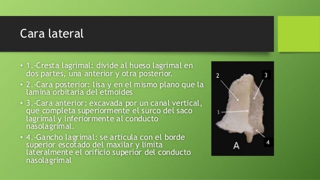 Hueso lagrimal (unguis)