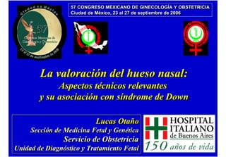 57 CONGRESO MEXICANO DE GINECOLOGÍA Y OBSTETRICIA
                  57 CONGRESO MEXICANO DE GINECOLOGÍA Y OBSTETRICIA
                  Ciudad de México, 23 al 27 de septiembre de 2006
                  Ciudad de México, 23 al 27 de septiembre de 2006




        La valoración del hueso nasal:
             Aspectos técnicos relevantes
        y su asociación con síndrome de Down

                          Lucas Otaño
     Sección de Medicina Fetal y Genética
                Servicio de Obstetricia
Unidad de Diagnóstico y Tratamiento Fetal
 