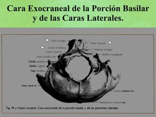 Cara Exocraneal de la Porción Basilar y de las Caras Laterales. 