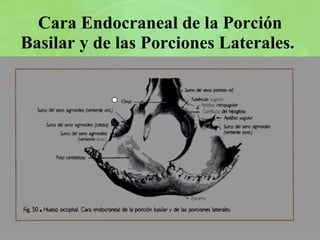 Cara Endocraneal de la Porción Basilar y de las Porciones Laterales.   