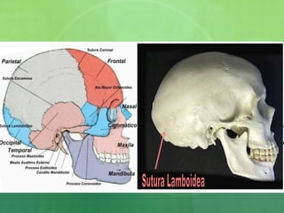 Sutura Lamboidea 