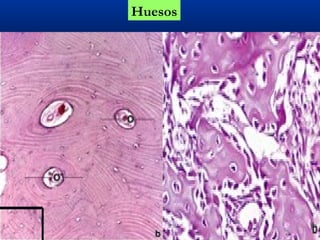 Huesos
 