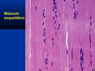 Músculo
esquelético
 