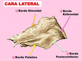 CARA LATERAL
 Borde Etmoidal
 Borde Palatino
 Borde
Esfenoidal
 Borde
Posteroinferior
 