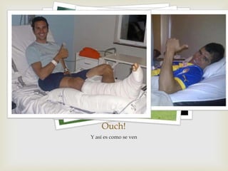 Ouch!
Y así es como se ven

 