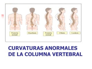 Huesos de la columna vertebral y miembro superior | PPTX