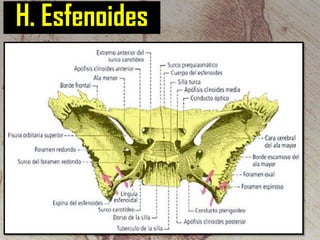 H. Esfenoides

 