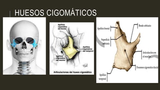 HUESOS CIGOMÁTICOS
 