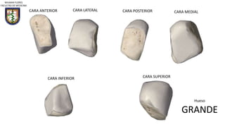 CARA ANTERIOR CARA LATERAL CARA POSTERIOR CARA MEDIAL
CARA INFERIOR CARA SUPERIOR
Hueso
GRANDE
WILMAN FLORES
FACULTAD DE MEDICINA
 
