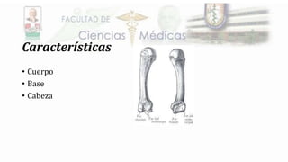 Características
• Cuerpo
• Base
• Cabeza
 