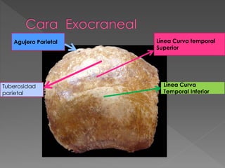 huesos del craneo .pdf