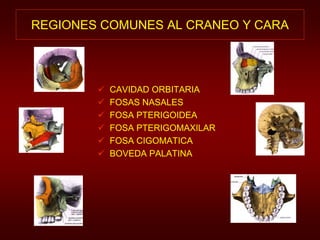 REGIONES COMUNES AL CRANEO Y CARA 
 CAVIDAD ORBITARIA 
 FOSAS NASALES 
 FOSA PTERIGOIDEA 
 FOSA PTERIGOMAXILAR 
 FOSA CIGOMATICA 
 BOVEDA PALATINA 
 
