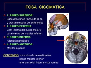 FOSA CIGOMATICA 
 1: PARED SUPERIOR 
- Base del cráneo ( base de la ap. 
y cresta temporal del esfenoides 
 2: PARED EXTERNA 
- Cara interna del hueso malar y 
cara interna del maxilar inferior 
 3: PARED INTERNA 
- Apófisis pterigoides 
 4: PARED ANTERIOR 
- Maxilar superior 
CONTENIDO: músculos de la masticación 
nervio maxilar inferior 
arteria maxilar interna y sus ramas 
 