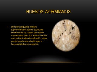 HUESOS WORMIANOS Son unos pequeños huesos supernumerarios que en ocasiones existen entre los huesos del cráneo normalmente descritos. Además de los centros habituales de osificación, otros pueden producirse, dando lugar a huesos aislados e irregulares.