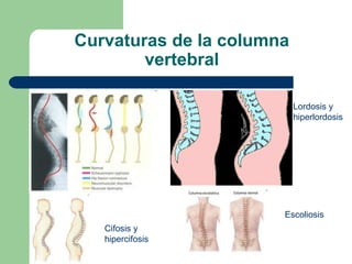 Curvaturas de la columna
vertebral
Lordosis y
hiperlordosis
Cifosis y
hipercifosis
Escoliosis
 