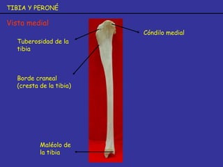 TIBIA Y PERONÉ
Vista medial
Cóndilo medial
Tuberosidad de la
tibia
Borde craneal
(cresta de la tibia)
Maléolo de
la tibia
 