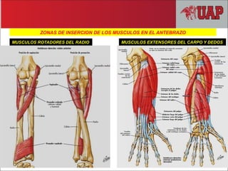 ZONAS DE INSERCION DE LOS MUSCULOS EN EL ANTEBRAZO
MUSCULOS ROTADORES DEL RADIO MUSCULOS EXTENSORES DEL CARPO Y DEDOS
 