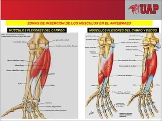 ZONAS DE INSERCION DE LOS MUSCULOS EN EL ANTEBRAZO
MUSCULOS FLEXORES DEL CARPOO MUSCULOS FLEXORES DEL CARPO Y DEDOS
 