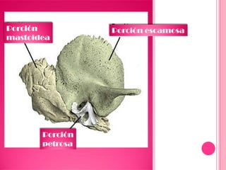Porción escamosaPorción
mastoidea
Porción
petrosa
 