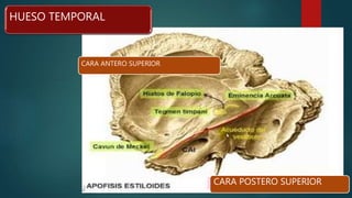 HUESO TEMPORAL
CARA ANTERO SUPERIOR
CARA POSTERO SUPERIOR
 