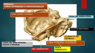 CANAL DEL SENO PETROSO
MENOR O INFERIOR
COD. AUDITIVO INT
FOSITA
SUBARCUATA
CANAL DEL SENOLATERAL
ACUEDUCTO DEL
VESTIBULO
PEÑASCO
CARAS SUPERIORES O ENDOCRANEALES
CARA ANTERO SUPERIOR
CARA POSTERO SUPERIOR
AGUJERO MASTOIDEO
 