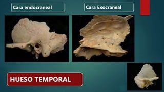 Cara Exocraneal
HUESO TEMPORAL
Cara endocraneal
 