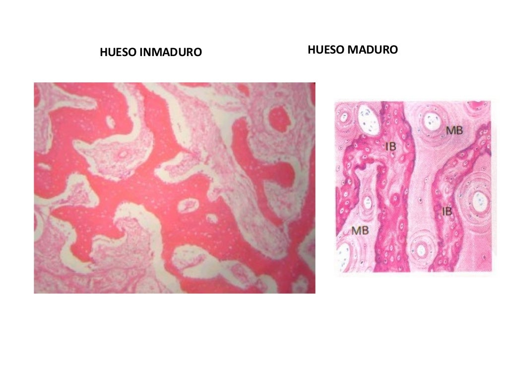 Diferencias Entre Hueso Y Cartilago Hueso y cartilago