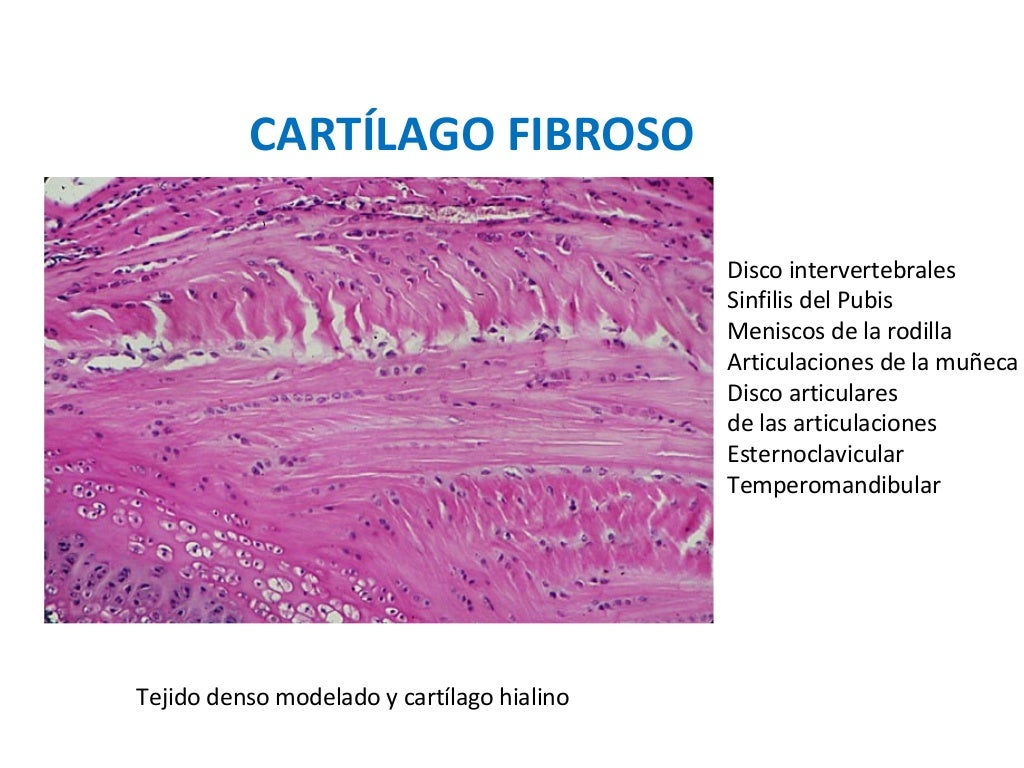 Diferencias Entre Hueso Y Cartilago Hueso y cartilago