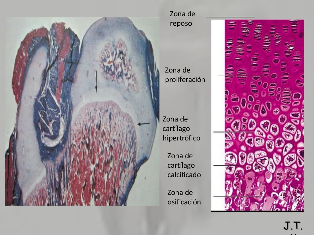 Diferencias Entre Hueso Y Cartilago Hueso y cartilago UPSJB
