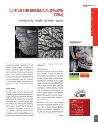 COMPANY PROFILE 
107 
SWISSKNOWHOW HUG 
CIBM 
EPFL SB IPSB LIFMET 
Station 6 
CH - 1015 Lausanne 
Tel.: +41 21 693 44 67 
+41 21 693 79 81 
Fax: +41 21 693 79 60 
E-mail : info@cibm.ch 
Web: www.cibm.ch 
CENTER FOR BIOMEDICAL IMAGING 
A collaboration model in the fi eld of research 
High-resolution structural MRI of the human cerebellum at 7 Tesla. From Marques et al. Radiology 2010 
The Center for Biomedical Imaging, directed by 
Professor Rolf Gruetter, is the result of a major 
research initiative between the University of 
Geneva (UNIGE), the Hôpitaux Universitaires de 
Genève (HUG), the Ecole Polytechnique Fédérale 
de Lausanne (EPFL), the University of Lausanne 
(UNIL), and Lausanne University Hospital 
(CHUV). Unique within the French-speaking area 
of Switzerland and in the world for its multi-site 
and multi-institutional aspects, the CIBM aims 
to foster synergies between these institutions by 
optimizing the use of its state-of-the-art equip-ment. 
Broad activity 
The CIBM is the outcome of a research and 
teaching initiative from the Sciences-Vie-Société 
(Science-Life-Society) project between the 5 insti-tutions. 
The Center is spread out over three sites: 
HUG, EPFL and CHUV. It has received generous 
funding from the Leenards and Louis-Jeantet 
Foundations, which continue to provide fi nan-cial 
support to all projects. Although the Center 
likes to defi ne itself using a simple equation of 
odd numbers (1 center, 3 sites, 5 institutions, 
7 research units, 9 professors), its fi eld of acti-vity 
is complex and extensive. Indeed, the Center 
specializes in biomedical imaging using magne-tic 
resonance imaging (MRI) with the support of 
phase contrast tomography, radioactive isotope 
(CIBM) 
imaging and brain mapping by electroencepha-lography 
(EEG). 
Clinical research 
The CIBM is organized around seven research 
units. There are 3 MRI units, one at the EPFL 
which concentrates on imaging on rodents and 
on technological development. Also related to 
the center’s speciality of MRI, a positron emission 
tomography unit has opened at the HUG and 
EPFL site. Positron emission tomography (PET) is 
a method of medical imaging practised by spe-cialists 
in nuclear medicine, which allows them 
to measure the metabolic activity of an organ 
in 3D. The HUG, in close collaboration with the 
CHUV, also house the brain mapping unit. This 
consists of a set of neuroscience techniques that 
seek to establish a link between the regions of 
the brain and functions or capacities. Finally, a 
signal and image processing unit completes the 
experimental units. 
The Center is unique because it brings together 
institutions which, although separated by some 
50 to 200 km, offer methods of imaging and 
analysis that are quite unparalleled, thanks to 
outstanding equipment and expertise. The com-mon 
goal is to become a recognized centre of 
excellence in the world of biomedical research. 
Somatotopy of human index 
representation following 
physiological touch 
of the individual index fi nger 
 