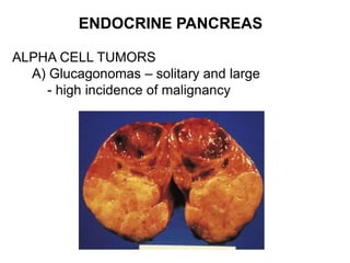 ENDOCRINE PANCREAS
ALPHA CELL TUMORS
A) Glucagonomas – solitary and large
- high incidence of malignancy
 
