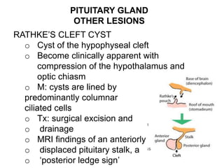 PITUITARY GLAND
OTHER LESIONS
RATHKE’S CLEFT CYST
o Cyst of the hypophyseal cleft
o Become clinically apparent with
compression of the hypothalamus and
optic chiasm
o M: cysts are lined by
predominantly columnar
ciliated cells
o Tx: surgical excision and
o drainage
o MRI findings of an anteriorly
o displaced pituitary stalk, a
o ‘posterior ledge sign’
 