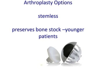 Arthroplasty Options
stemless
preserves bone stock –younger
patients
 