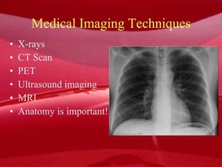 Medical Imaging Techniques X-rays  CT Scan  PET Ultrasound imaging MRI  Anatomy is important! 