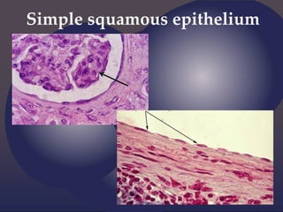 Simple squamous epithelium
 