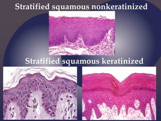 Stratified squamous nonkeratinized
Stratified squamous keratinized
 