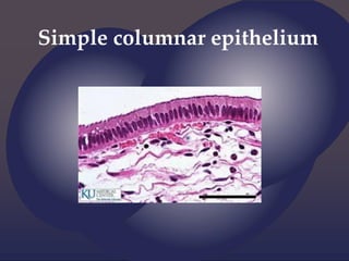 Simple columnar epithelium
 