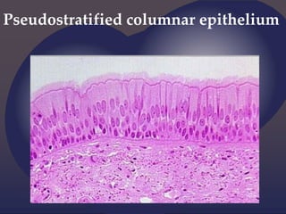 Pseudostratified columnar epithelium
 