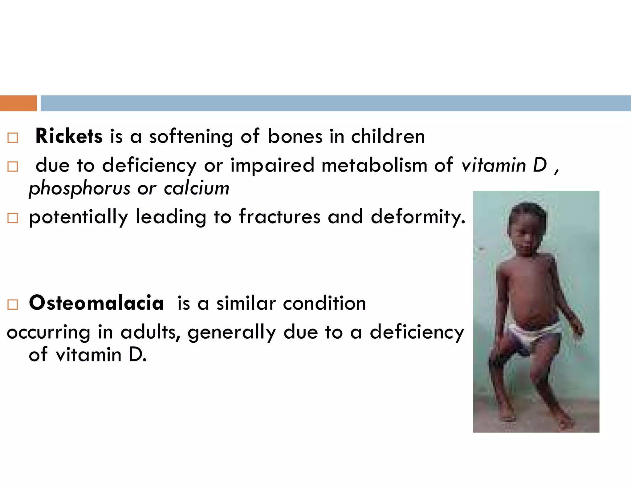  Rickets is a softening of bones in children
 due to deficiency or impaired metabolism of vitamin D ,
phosphorus or calcium
 potentially leading to fractures and deformity.
 Osteomalacia is a similar condition
occurring in adults, generally due to a deficiency
of vitamin D.
 