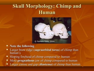 Skull Morphology: Chimp and
Human








Note the following
Larger brow ridge (supraorbital torus) of chimp than
human’s
Sloping forehead of chimp compared to human
More prognathous jaw of chimp compared to human
Larger canine and gap (diastema) of chimp than human

 
