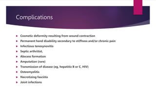 Complications
 Cosmetic deformity resulting from wound contraction
 Permanent hand disability secondary to stiffness and/or chronic pain
 Infectious tenosynovitis
 Septic arthritist,
 Abscess formation
 Amputation (rare)
 Transmission of disease (eg, hepatitis B or C, HIV)
 Osteomyelitis
 Necrotizing fasciitis
 Joint infections
 