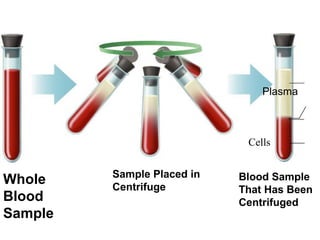 Whole 
Blood 
Sample 
Plasma 
Sample Placed in 
Centrifuge 
Cells 
Blood Sample 
That Has Been 
Centrifuged 
 