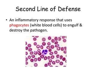 Second Line of Defense
• An inflammatory response that uses
phagocytes (white blood cells) to engulf &
destroy the pathogen.
 