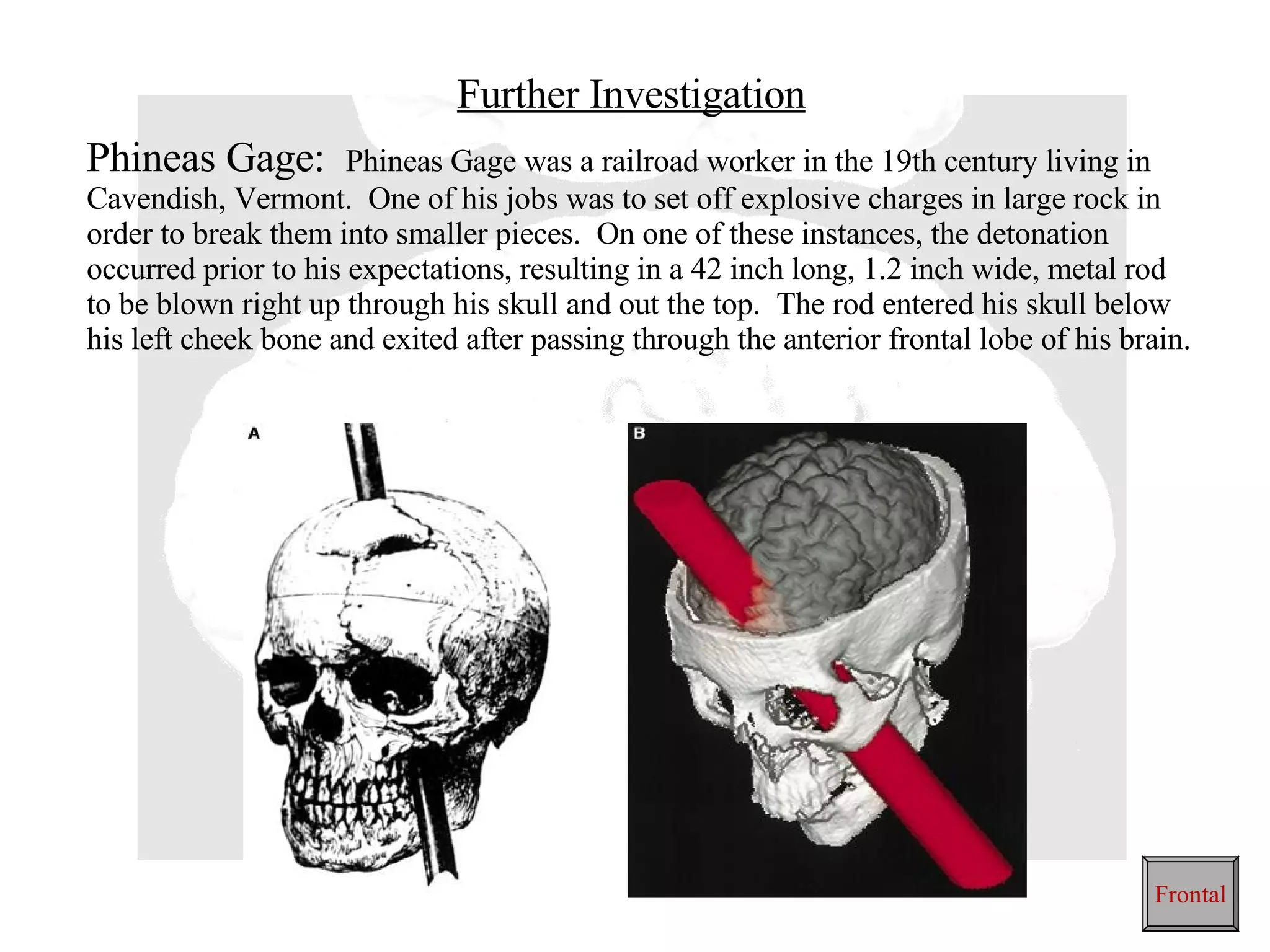 Further Investigation Phineas Gage:  Phineas Gage was a railroad worker in the 19th century living in Cavendish, Vermont.  One of his jobs was to set off explosive charges in large rock in order to break them into smaller pieces.  On one of these instances, the detonation occurred prior to his expectations, resulting in a 42 inch long, 1.2 inch wide, metal rod to be blown right up through his skull and out the top.  The rod entered his skull below his left cheek bone and exited after passing through the anterior frontal lobe of his brain. Frontal 